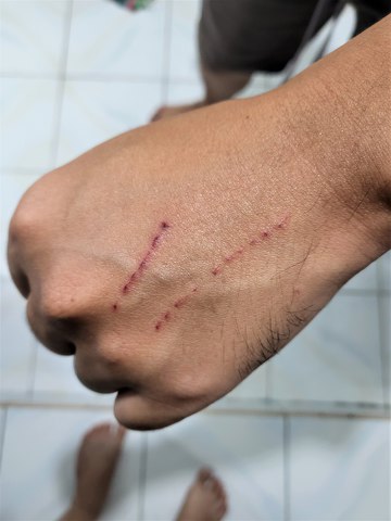 cat bite free rabies shot cebu